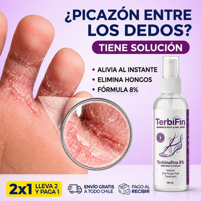 TerbiFin Spray 8% Anti-Hongos Pies y Uñas